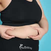 6 Benefits of the Spatz Intragastric Balloon in Mexico for Americans Seeking Non-Invasive Weight Loss
